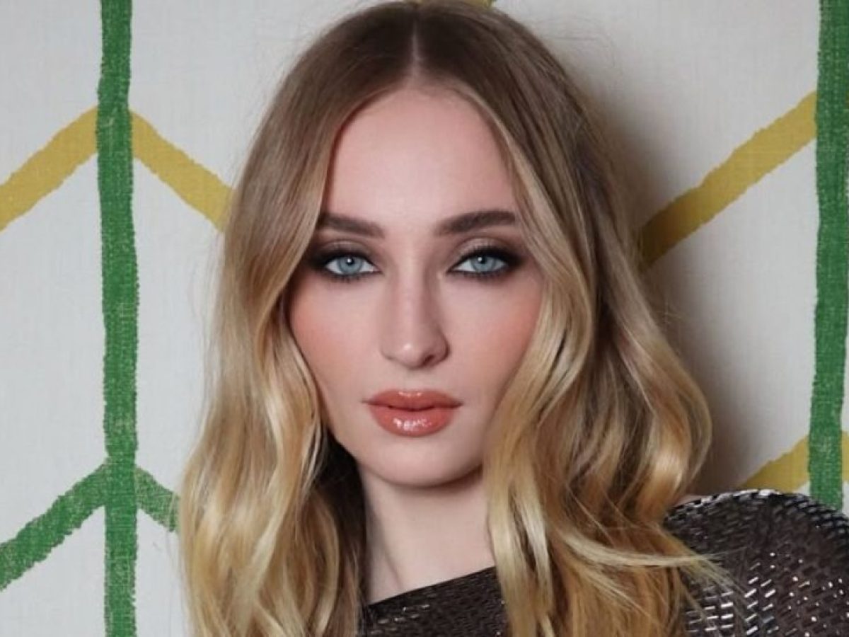 Lip filler aftercare: Όλα όσα πρέπει να προσέξεις αμέσως μετά από τη θεραπεία