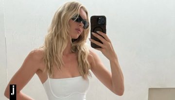 Πώς να απαλύνεις τις καφέ κηλίδες στο σώμα χωρίς λέιζερ