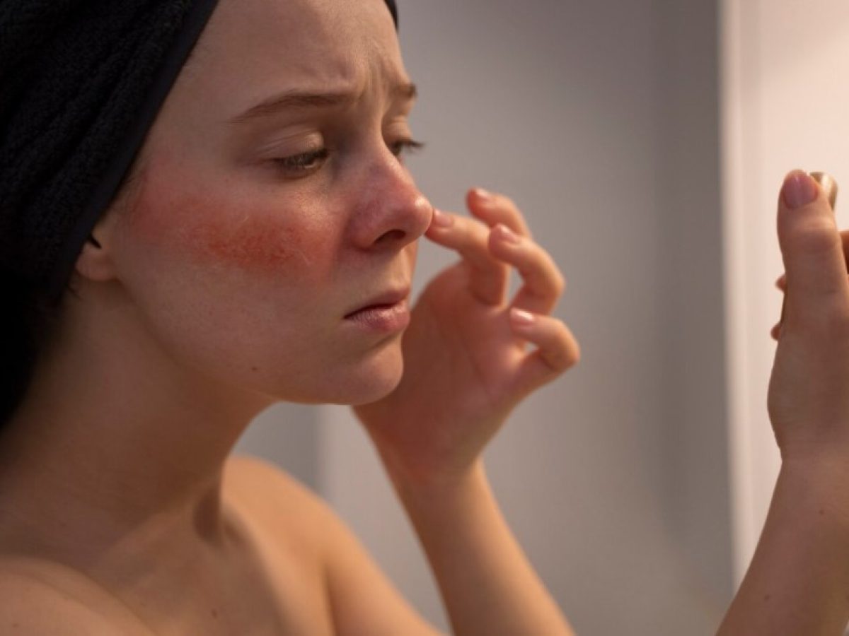 Πιο ισχυρό από το υαλουρονικό οξύ, αυτό το αντιφλεγμονώδες δραστικό συστατικό αναδεικνύεται ως ο νέος σύμμαχος της ευαίσθητης επιδερμίδας