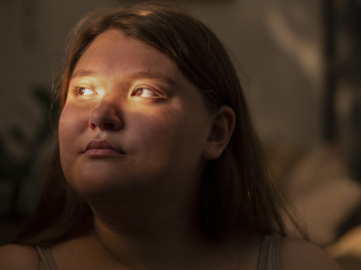 «Cortisol face»: Μπορεί το στρες να προκαλέσει πραγματικά πρήξιμο στο πρόσωπο;