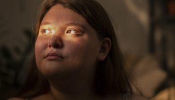 «Cortisol face»: Μπορεί το στρες να προκαλέσει πραγματικά πρήξιμο στο πρόσωπο;
