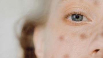 Αυτό είναι το skin detox που χρειάζεστε μετά το Πάσχα