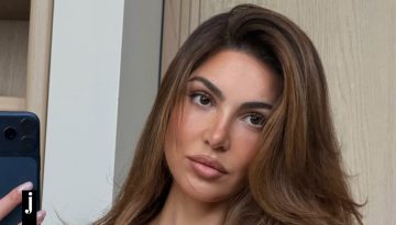 Ξέχασε τα fillers: Πώς να αποκτήσεις ζουμερά χείλη με φυσικό τρόπο